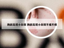 胸前出现小白斑 胸前出现小白斑不痛不痒