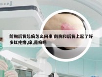 前胸后背起癣怎么回事 前胸和后背上起了好多红疙瘩,痒,是癣吗