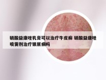 硝酸益康唑乳膏可以治疗牛皮癣 硝酸益康唑喷雾剂治疗银屑病吗