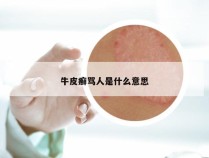 牛皮癣骂人是什么意思