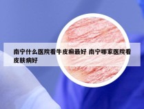 南宁什么医院看牛皮癣最好 南宁哪家医院看皮肤病好