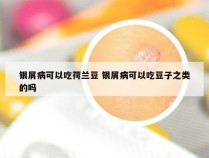 银屑病可以吃荷兰豆 银屑病可以吃豆子之类的吗