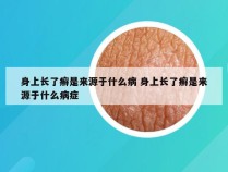 身上长了癣是来源于什么病 身上长了癣是来源于什么病症