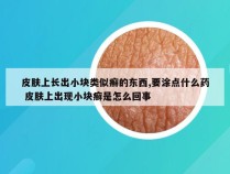 皮肤上长出小块类似癣的东西,要涂点什么药 皮肤上出现小块癣是怎么回事