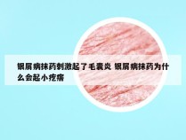 银屑病抹药刺激起了毛囊炎 银屑病抹药为什么会起小疙瘩