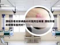 濮阳市看皮肤病最好的医院在哪里 濮阳市看皮肤哪家医院好?