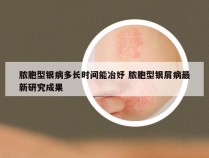 脓胞型银病多长时间能冶妤 脓胞型银屑病最新研究成果