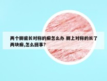 两个脚底长对称的癣怎么办 脚上对称的长了两块癣,怎么回事?