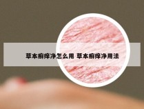 草本癣痒净怎么用 草本癣痒净用法