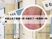 大腿上长了象藓一样 大腿长了一些像癣一样的