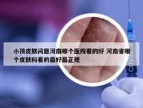 小孩皮肤问题河南哪个医院看的好 河南省哪个皮肤科看的最好最正规