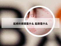 起癣的原因是什么 起藓是什么