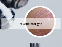 牛皮癣的chengyin