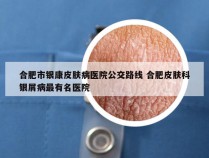 合肥市银康皮肤病医院公交路线 合肥皮肤科银屑病最有名医院