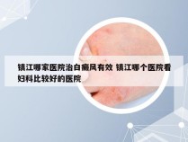 镇江哪家医院治白癜风有效 镇江哪个医院看妇科比较好的医院