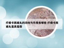 疗癣卡西甫丸的功效与作用有哪些 疗癣卡西甫丸是真是假