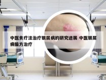 中医食疗法治疗银屑病的研究进展 中医银屑病偏方治疗