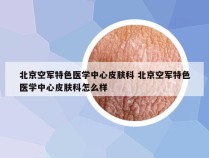 北京空军特色医学中心皮肤科 北京空军特色医学中心皮肤科怎么样