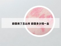 藓霸用了怎么样 藓霸多少钱一盒