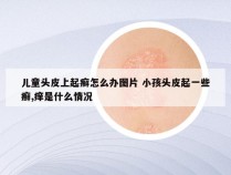 儿童头皮上起癣怎么办图片 小孩头皮起一些癣,痒是什么情况