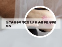 治疗头癣中不可吃什么食物 头藓不能吃哪些东西