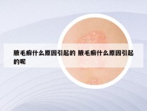 腋毛癣什么原因引起的 腋毛癣什么原因引起的呢