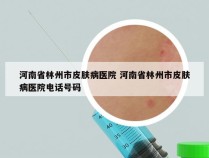 河南省林州市皮肤病医院 河南省林州市皮肤病医院电话号码