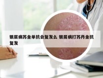 银屑病苏金单抗会复发么 银屑病打苏丹金抗复发