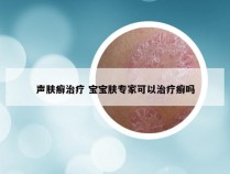 声肤癣治疗 宝宝肤专家可以治疗癣吗