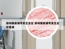 郑州银屑病专家王主任 郑州银屑病专家王主任是谁