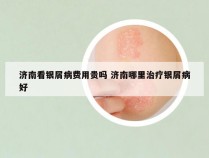 济南看银屑病费用贵吗 济南哪里治疗银屑病好