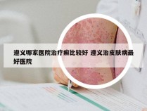 遵义哪家医院治疗癣比较好 遵义治皮肤病最好医院