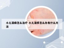 小儿湿癣怎么治疗 小儿湿疹怎么办有什么方法