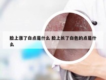 脸上涨了白点是什么 脸上长了白色的点是什么