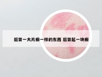 后背一大片癣一样的东西 后背起一块癣