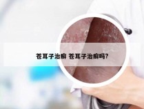 苍耳子治癣 苍耳子治癣吗?