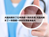 大腿内侧长了几块像癣一样的东西 大腿内侧长了一块像癣一样的东西越来越大