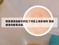 银屑病清血解中药吃了对肾上有影响吗 银屑病清热解毒凉血