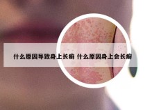 什么原因导致身上长癣 什么原因身上会长癣