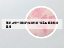 张家口哪个医院的皮肤科好 张家口看皮肤哪里好