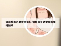 银屑病有必要看医生吗 银屑病有必要看医生吗知乎