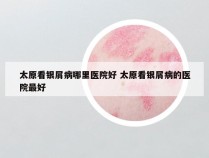 太原看银屑病哪里医院好 太原看银屑病的医院最好