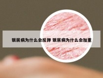 银屑病为什么会反弹 银屑病为什么会加重