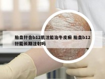 胎盘针合b12肌注能治牛皮癣 胎盘b12针能长期注射吗