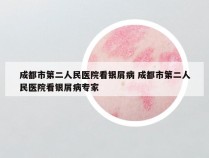 成都市第二人民医院看银屑病 成都市第二人民医院看银屑病专家