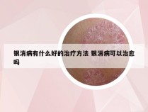 银消病有什么好的治疗方法 银消病可以治愈吗