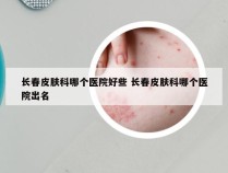 长春皮肤科哪个医院好些 长春皮肤科哪个医院出名