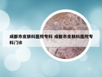 成都市皮肤科医院专科 成都市皮肤科医院专科门诊