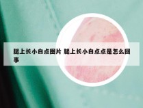 腿上长小白点图片 腿上长小白点点是怎么回事