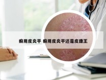 癣用皮炎平 癣用皮炎平还是皮康王